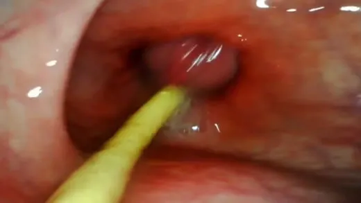 Imagen del video C&aacute;mara dentro del culo en un anal pov extremo